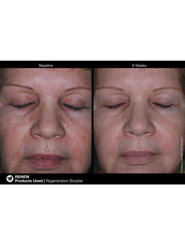 Jan Marini Regeneration Booster face cream in a 1 oz bottle with a sleek design and clear label.