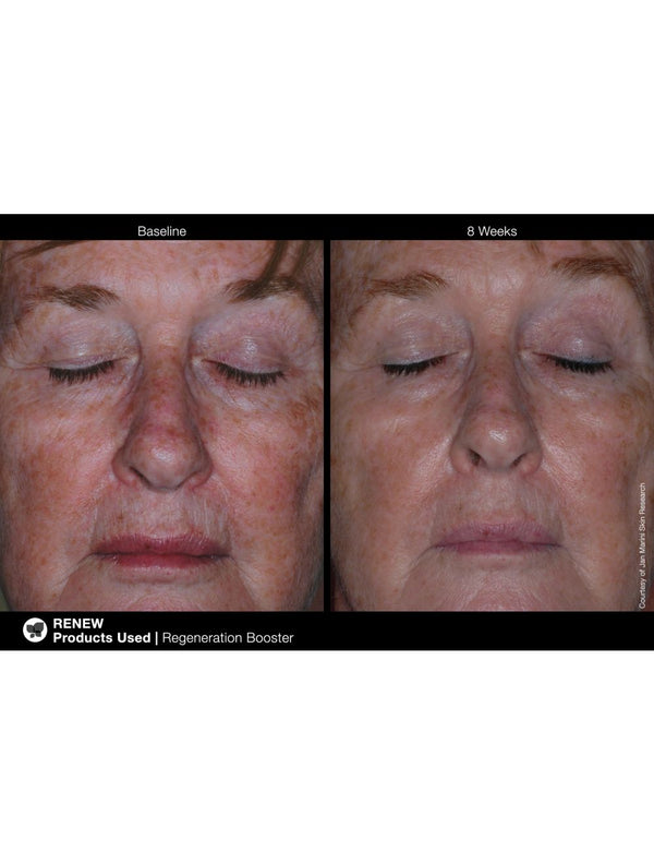 Jan Marini Regeneration Booster 1 oz face cream in a sleek bottle, designed for skin rejuvenation and hydration.