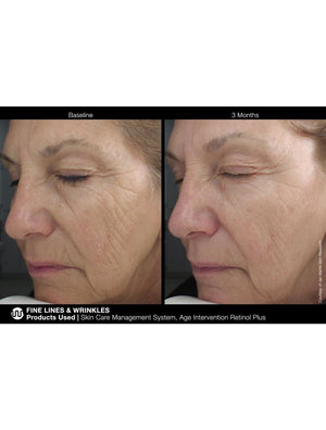 Jan Marini Age Intervention Retinol Plus - European Beauty by B