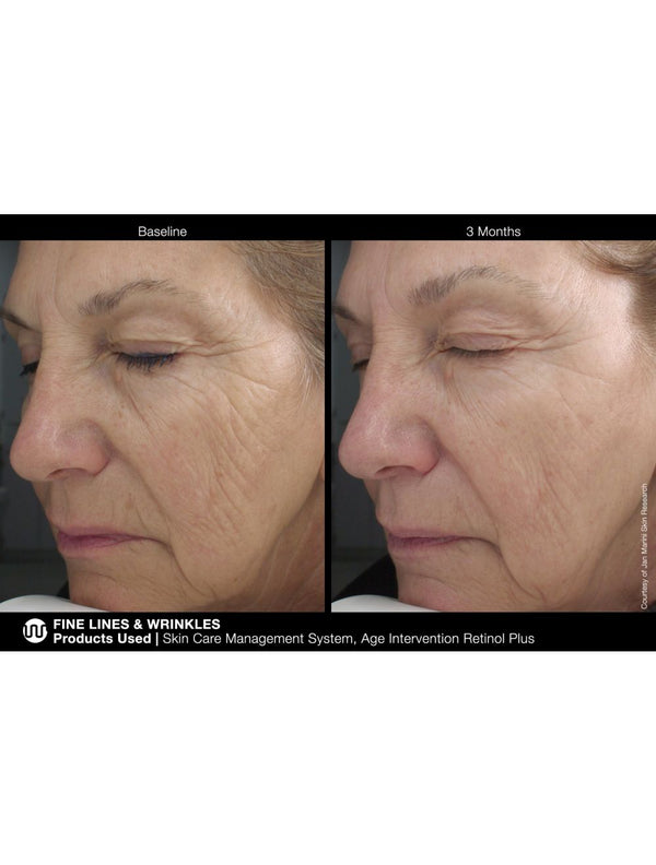 Jan Marini Age Intervention Retinol Plus - European Beauty by B