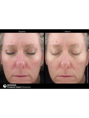 Jan Marini RosaLieve - European Beauty by B