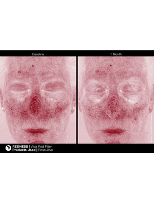 Jan Marini RosaLieve - European Beauty by B