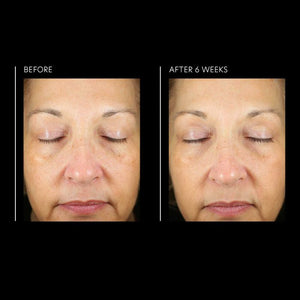 PCA Skin Hyaluronic Acid Overnight Mask 1.8 fl oz - European Beauty by B