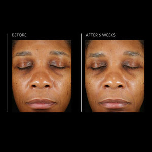 PCA Skin Hyaluronic Acid Overnight Mask 1.8 fl oz - European Beauty by B