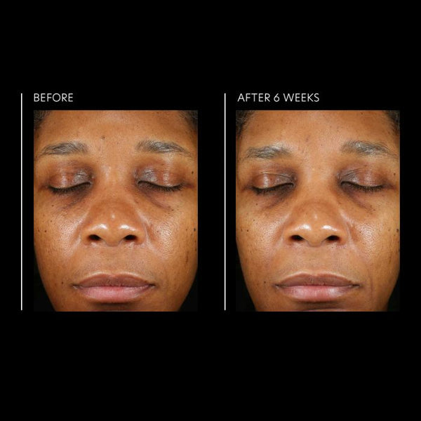 PCA Skin Hyaluronic Acid Overnight Mask 1.8 fl oz - European Beauty by B