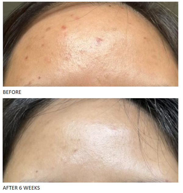 Glowbiotics Probiotic Triple Action Clarifying Pads - product image 7