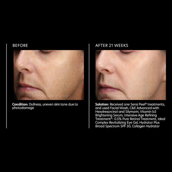 PCA Skin Vitamin B3 Eye Brightening Serum in a sleek bottle, designed for brightening the eye, neck, and lip areas.